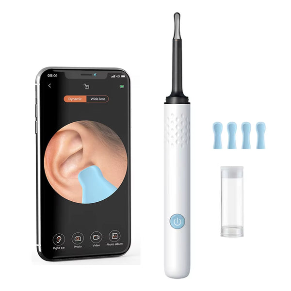 WIFI Visual Ear Cleaner Otoscope Camera with 6 LED Lights 4.0Mm Mini Ear Wax Removal Tool with Camera Take Video 500W HD Earpick